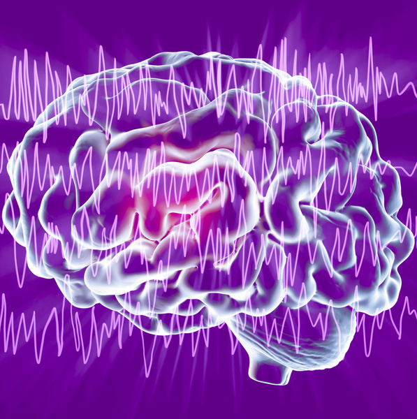 Epilepsia: o que é, como se diagnostica e trata, o que fazer perante uma crise?