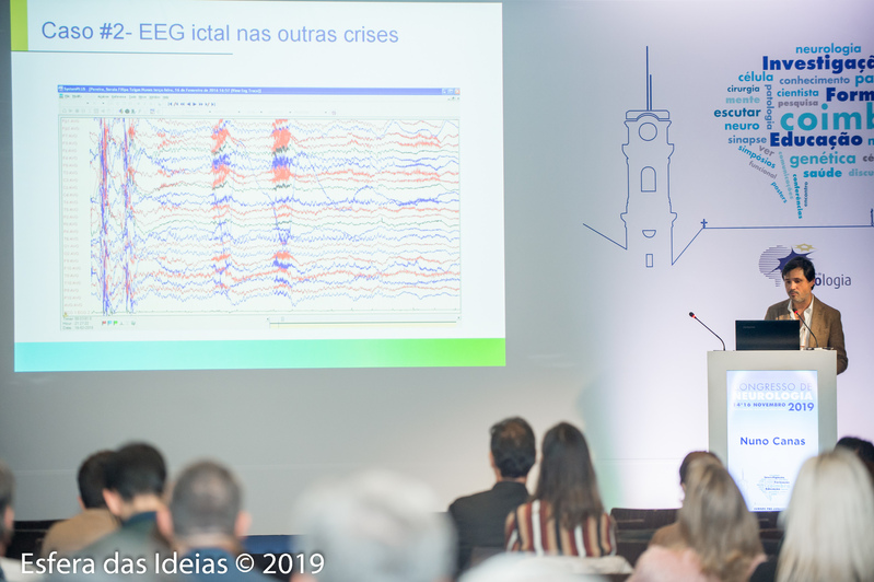 Dia 3 - Epilepsias refratarias