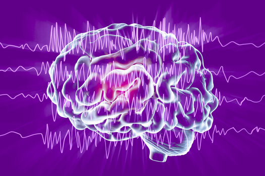 Epilepsia: o que é, como se diagnostica e trata, o que fazer perante uma crise?